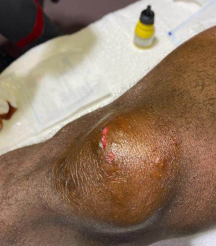 开云官方app入口-首红！赵宏略“废人式”飞踹巴索戈 中超新恶人诞生？